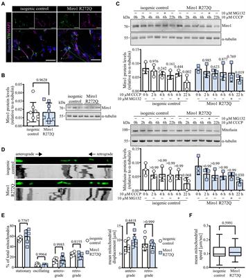 Miro1 R272Q disrupts mitochondrial calcium handling and neurotransmitter uptake in dopaminergic neurons